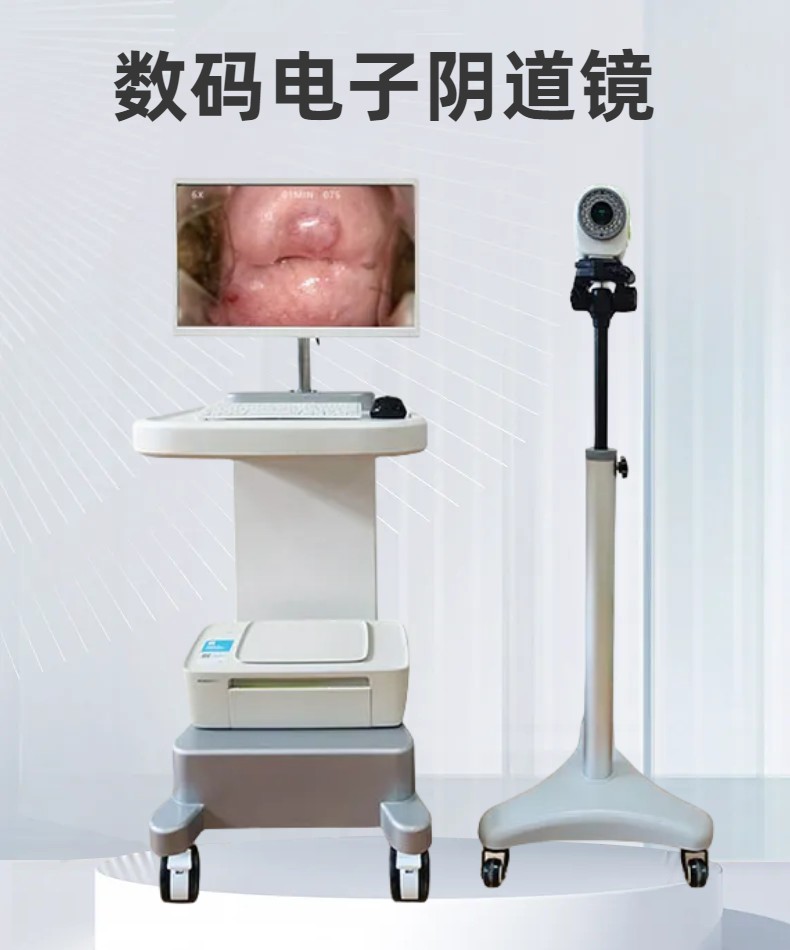 数码电子阴道镜 (36)