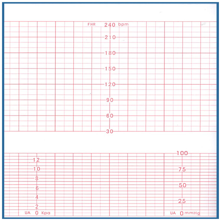 F6胎监纸152×90-150P理邦EDAN热敏纸打印纸